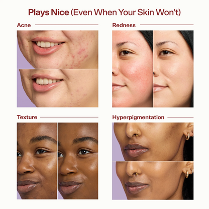 🎉BUY 1, GET 1 FREE — Your Skin, Just More Even
