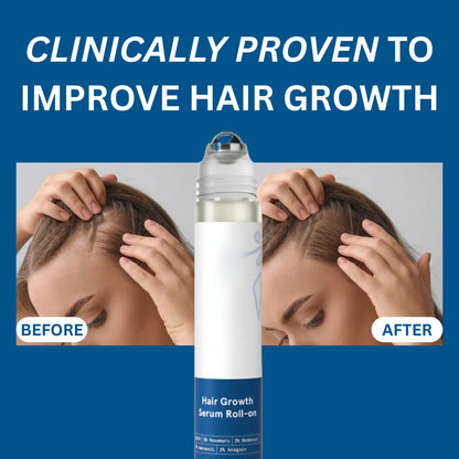 🎉BUY 1 GET 1 FREE🎉Hair Growth Roll on Serum