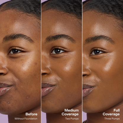 🎉BUY 1, GET 1 FREE — Your Skin, Just More Even