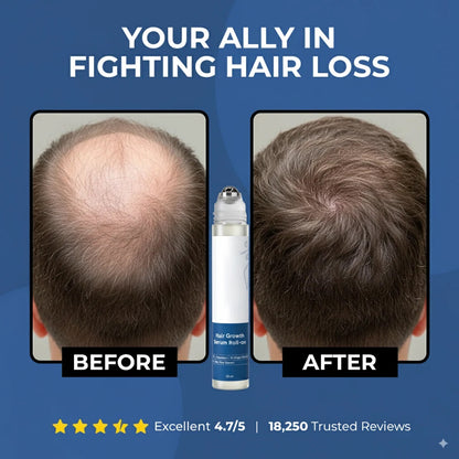 🎉BUY 1 GET 1 FREE🎉Hair Growth Roll on Serum